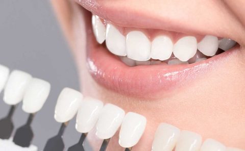 teeth-whitening-certification-classes